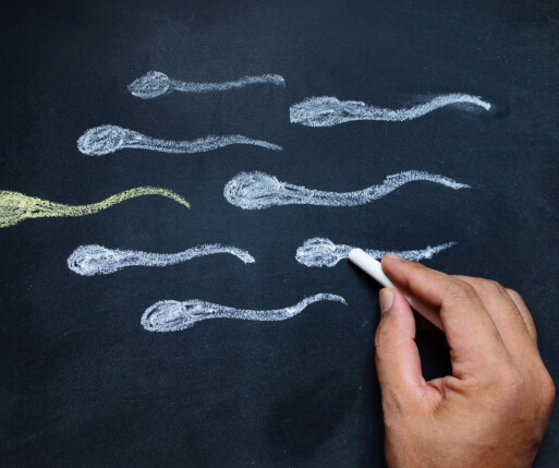 Male Subfertility Treatment